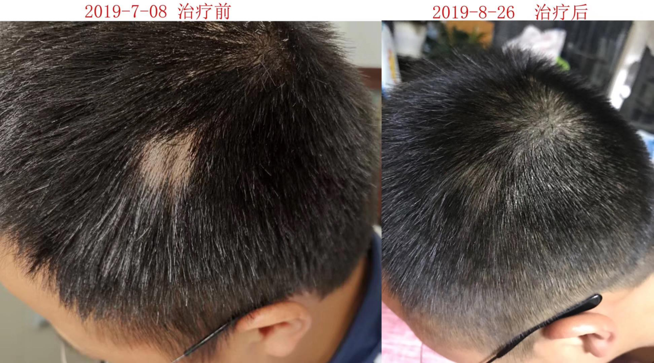 侬弯浦都固发生发洗发液